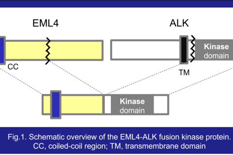 ALK drug resistant mutations: Challenges for the treatment of lung cancer